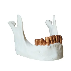 variant
